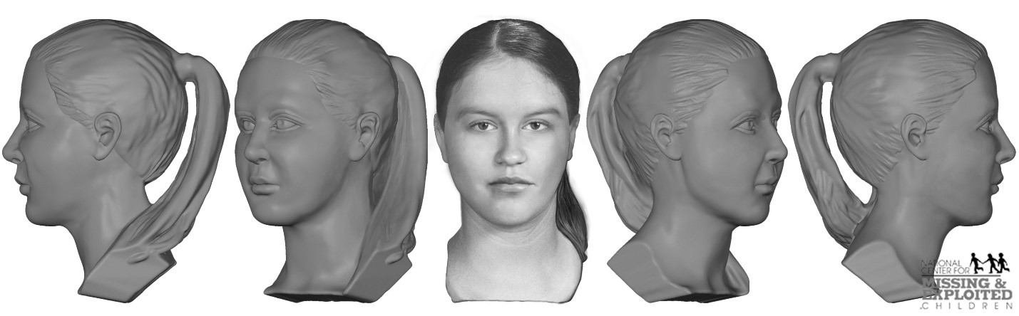 skull reconstruction